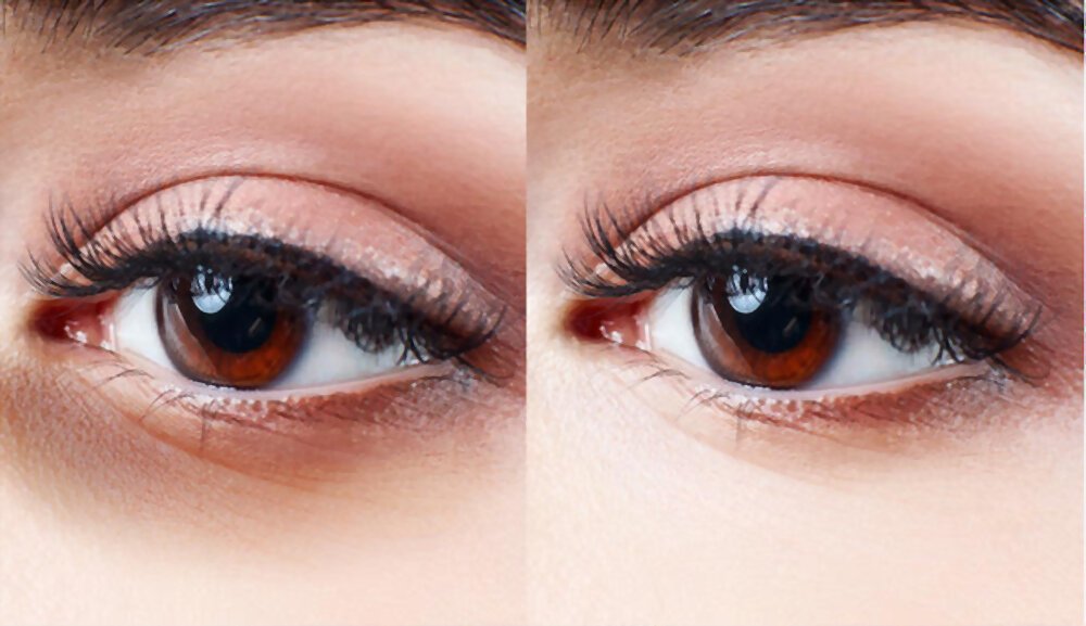 Dark Circles Under Brown Eyes