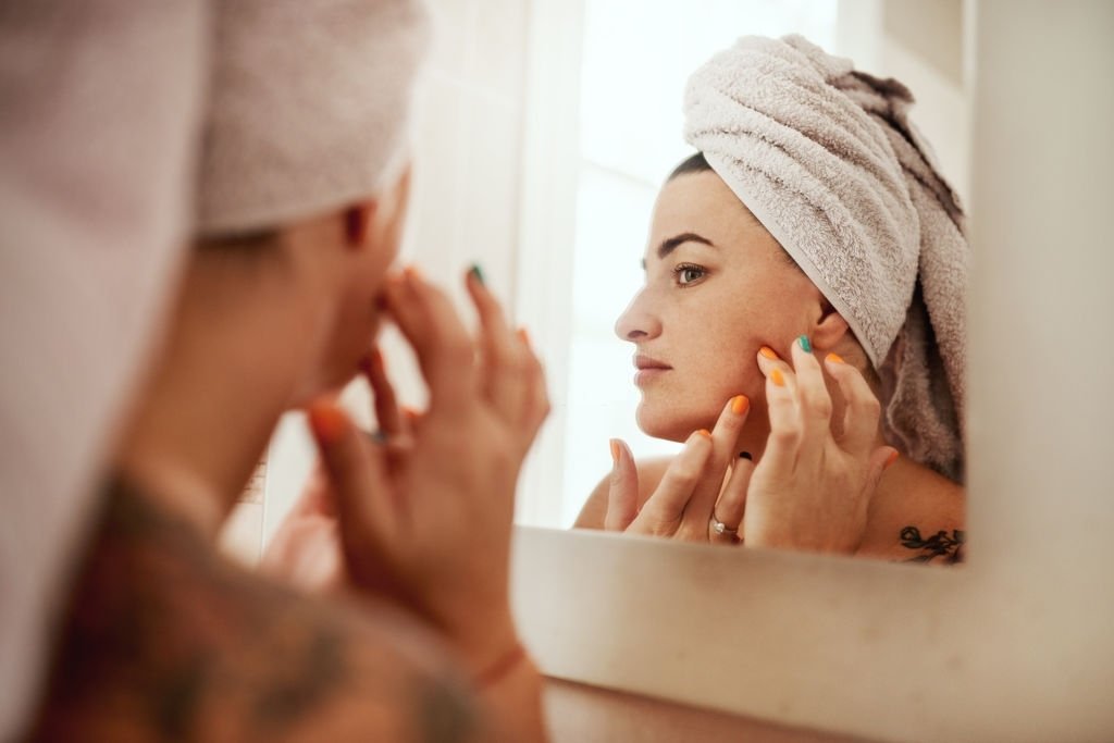 Causes of Skin Acne