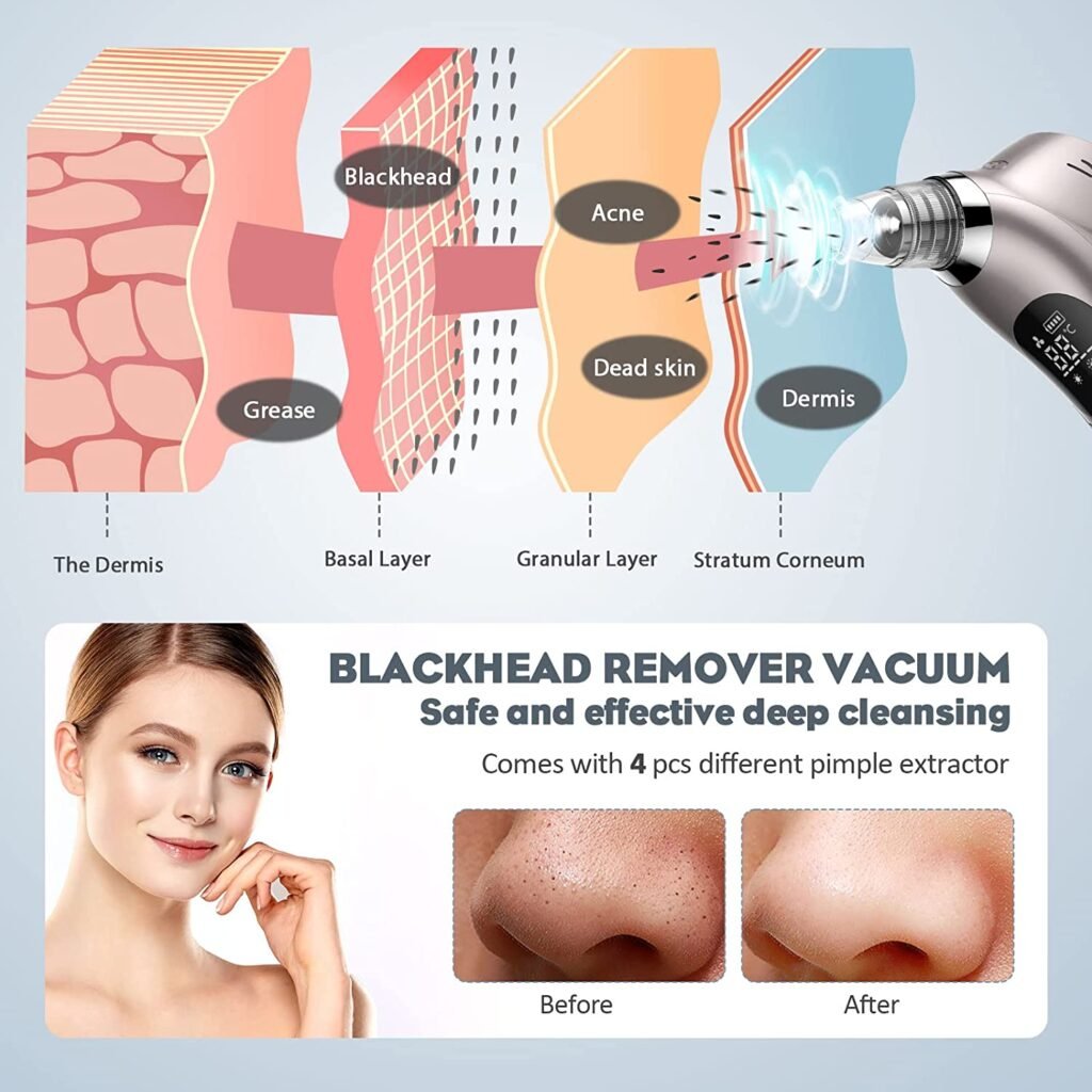 Blackhead Remover Vacuum Benefits