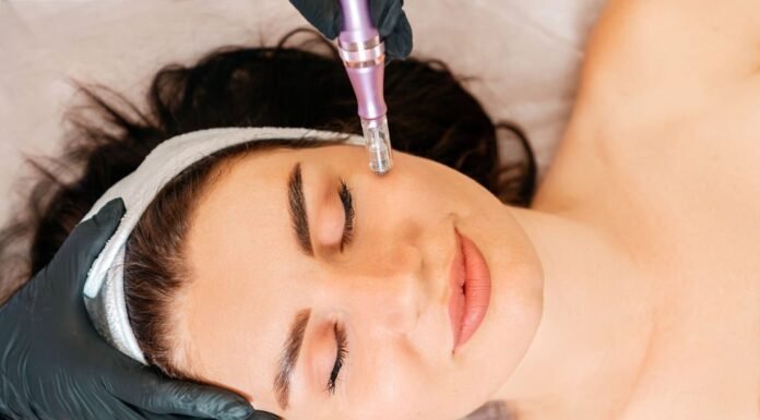The Amazing Benefits of Microneedling Treatments Benefits of Microneedling Treatments