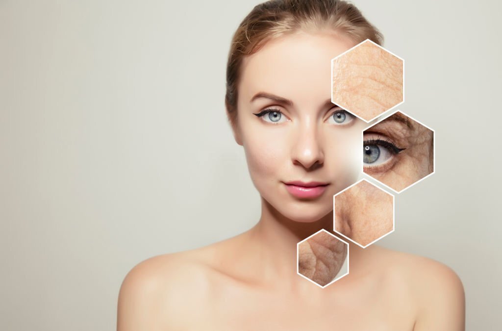 Botox and Confidence