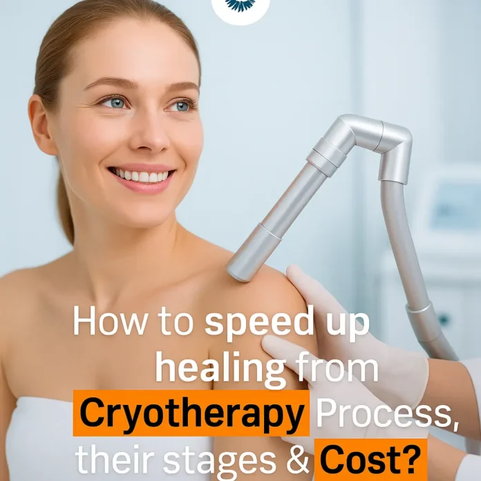 speed up Cryotherapy Healing Process